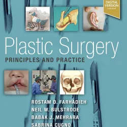 Plastic Surgery - Principles and Practice-1E