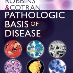 Pocket Companion to Robbins & Cotran Pathologic Basis of Disease - 10E