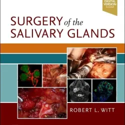 Surgery of the Salivary Glands-E