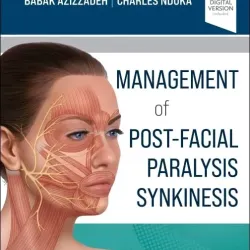 Management of Post-Facial Paralysis Synkinesis-1E