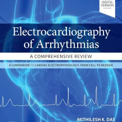 Electrocardiography of Arrhythmias: A Comprehensive Review-2E