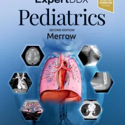 EXPERTddx: Pediatrics-2E