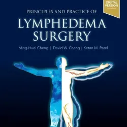 Principles and Practice of Lymphedema Surgery-2E