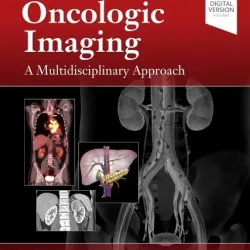 Oncologic Imaging: A Multidisciplinary Approach-2E