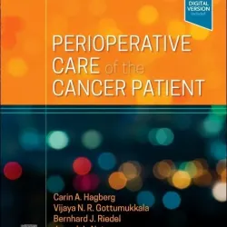 Perioperative Care of the Cancer Patient-1E