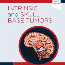 Intrinsic and Skull Base Tumors: Case Comparison Series -1E