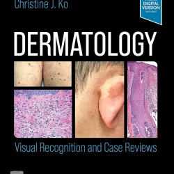 Dermatology: Visual Recognition and Case Reviews-2E