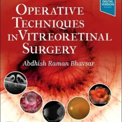 Operative Techniques in Vitreoretinal Surgery-1E