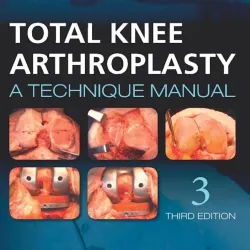 Total Knee Arthroplasty - 3E