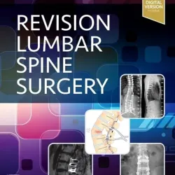 Revision Lumbar Spine Surgery-1E