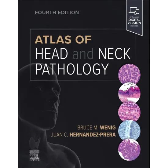 Atlas of Head and Neck Pathology-4E