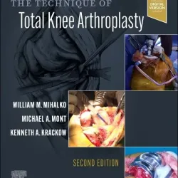 The Technique of Total Knee Arthroplasty-2E