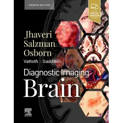 Diagnostic Imaging: Brain-4ED