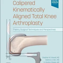 Calipered Kinematically aligned Total Knee Arthroplasty-1E