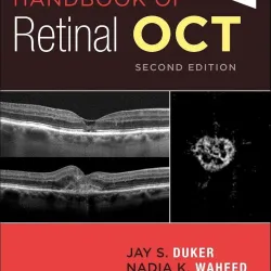 Handbook of Retinal OCT: Optical Coherence Tomography-2E