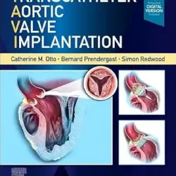 Transcatheter Aortic Valve Implantation - 1E