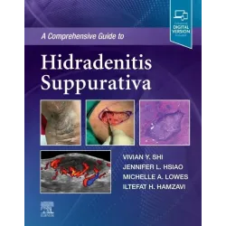 A Comprehensive Guide to Hidradenitis Suppurativa-1E