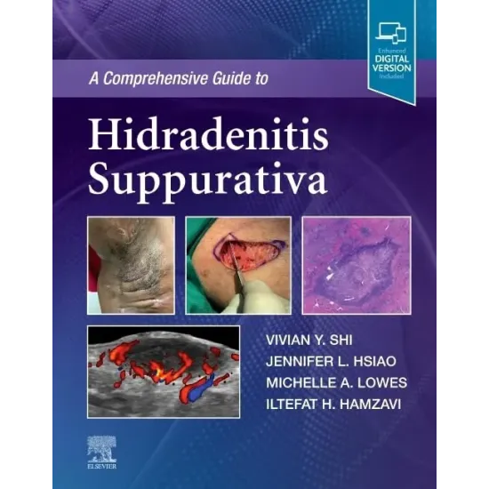 A Comprehensive Guide to Hidradenitis Suppurativa-1E