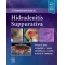 A Comprehensive Guide to Hidradenitis Suppurativa-1E