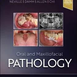 Oral and Maxillofacial Pathology - 5E