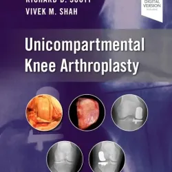 Unicompartmental Knee Arthroplasty-1E