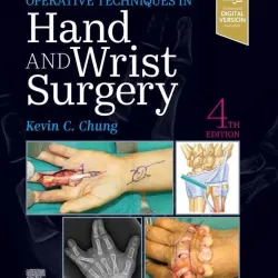 Operative Techniques: Hand and Wrist Surgery - 4E