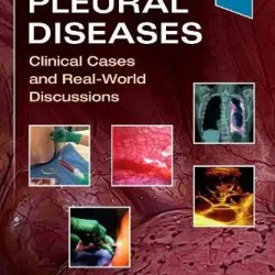 Pleural Diseases-1E