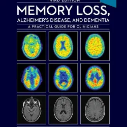 Memory Loss, Alzheimer's Disease and Dementia-3E