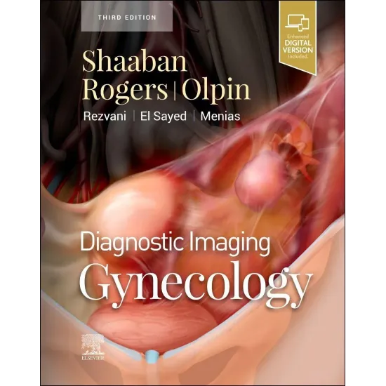 Diagnostic Imaging: Gynecology - 3ED