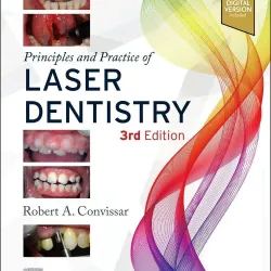 Principles and Practice of Laser Dentistry-3E