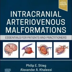 Intracranial Arteriovenous Malformations: Essentials for Patients and Practitioners - 1E