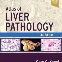 Atlas of Liver Pathology - 4E 