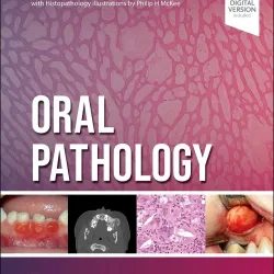 Oral Pathology - 3E