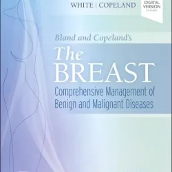 Bland and Copeland's The Breast-6E