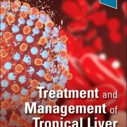 Treatment and Management of Tropical Liver Disease:  1E