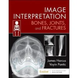 Image Interpretation: Bones, Joints, and Fractures - 1E