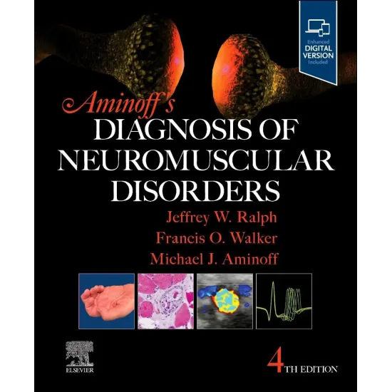 Aminoff's Diagnosis of Neuromuscular Disorders - 4E