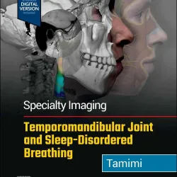 Specialty Imaging: Temporomandibular Joint and Sleep-Disordered Breathing-2E