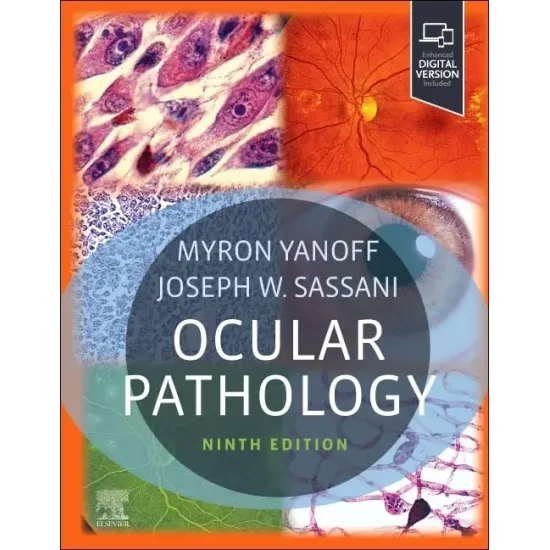 Ocular Pathology:  9E