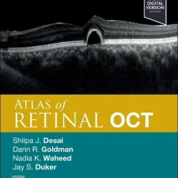 Atlas of Retinal OCT: Optical Coherence Tomography - 2E