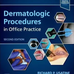 Dermatologic Procedures in Office Practice - 2E