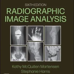 Workbook for Radiographic Image Analysis -6E