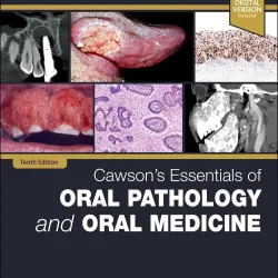 Cawson's Essentials of Oral Pathology and Oral Medicine