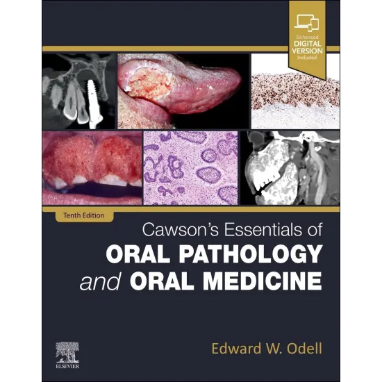 Cawson's Essentials of Oral Pathology and Oral Medicine