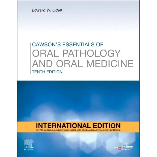 Cawson's Essentials of Oral Pathology and Oral Medicine, IE 10th Edition