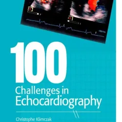 100 Challenges in Echocardiography