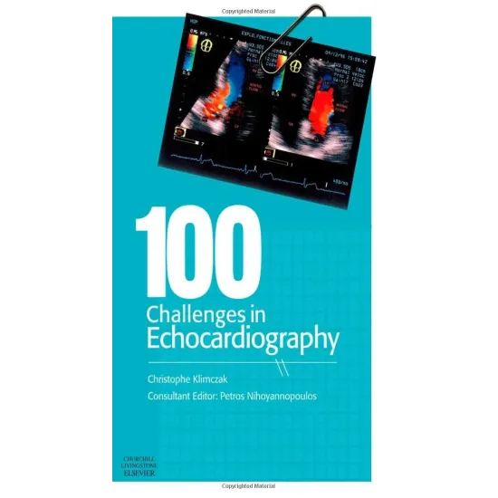 100 Challenges in Echocardiography