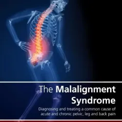 The Malalignment Syndrome-2E