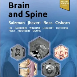 ExpertDDx: Brain and Spine - 3E