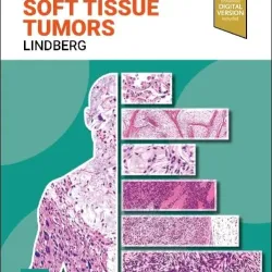 Diagnostic Pathology: Soft Tissue Tumors-4E